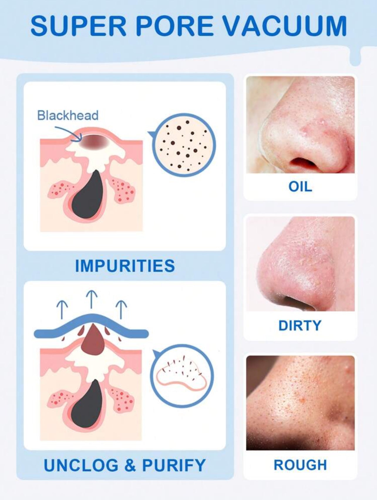 Blackhead Remover