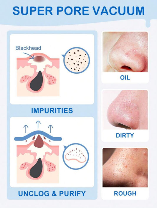 Blackhead Remover